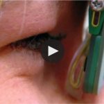 Performing a test on the brain post concussion