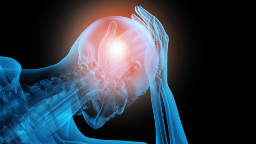 concussion patient scan illustration