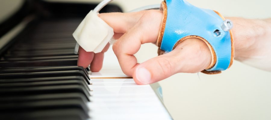 person with dystonia and brace on hand