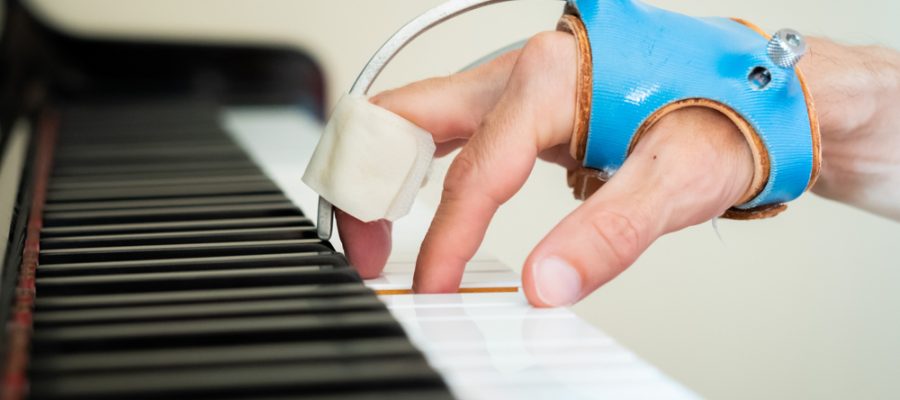 person playing piano with focal dystonia