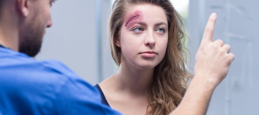 young woman tested for concussion symptoms