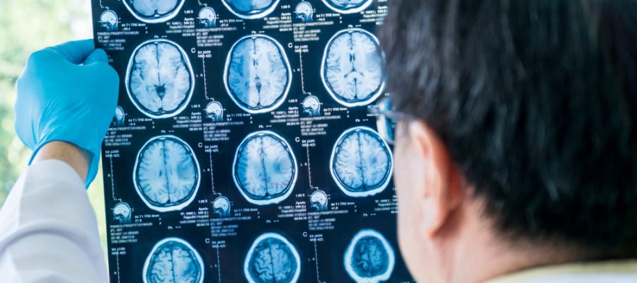 concussion specialist checks brain scans