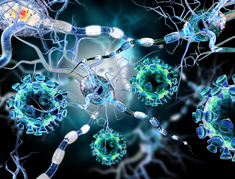Neuroplasticity illustration shows movement disorder in brain cells